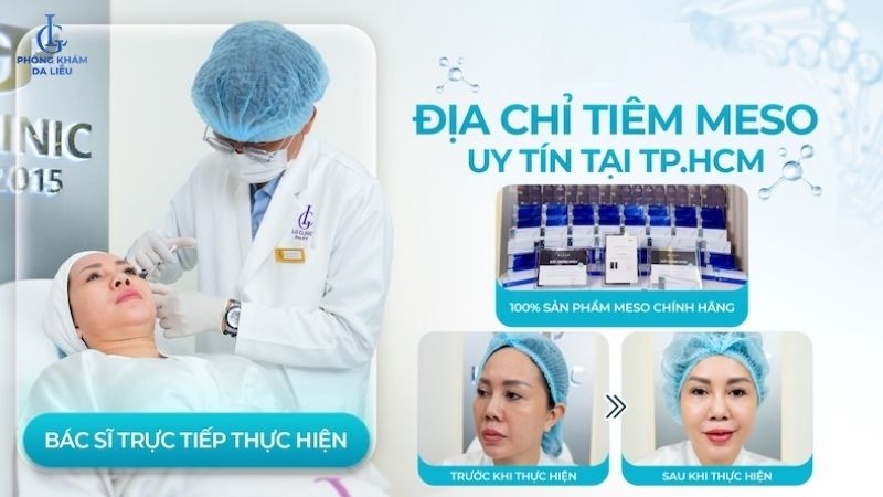 Tiêm collagen làm đầy sẹo lõm