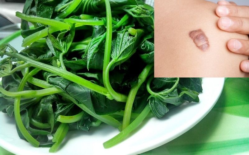 ăn rau lang có bị sẹo lồi không