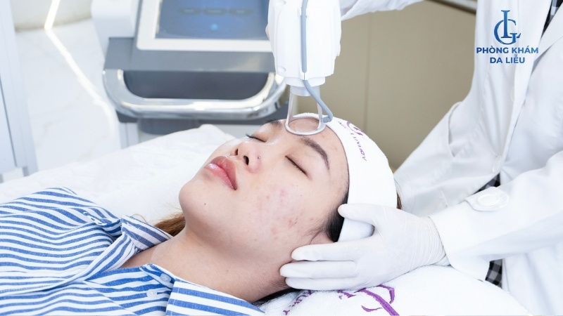 điều trị sẹo rỗ bằng lasr fractional co2