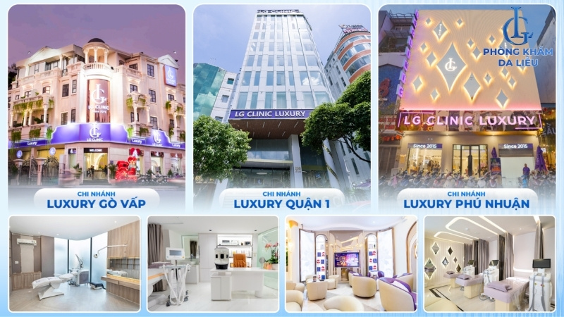 điều trị sẹo rỗ hiệu quả tại TPHCM