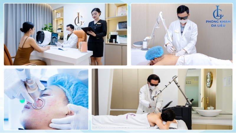 điều trị sẹo rỗ tại phòng khám da liễu lg tphcm