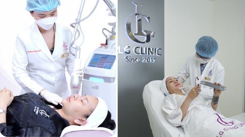 điều trị sẹo rỗ bằng laser fractional co2