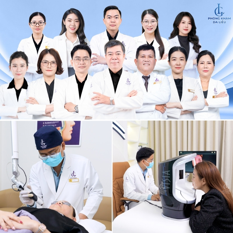 liệu trình điều trị sẹo rỗ 2 buổi cải thiện tại LG