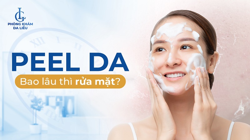 Peel da bao lâu thì rửa mặt