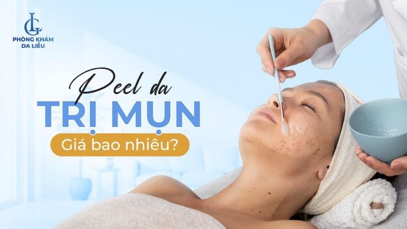 peel da trị mụn giá bao nhiêu
