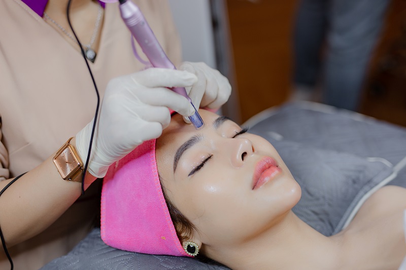 peel da trị mụn