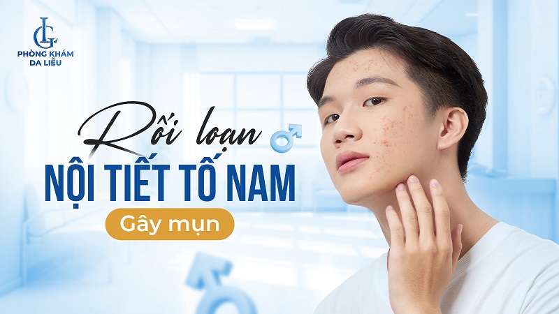 rối loạn nội tiết tố nam gây mụn