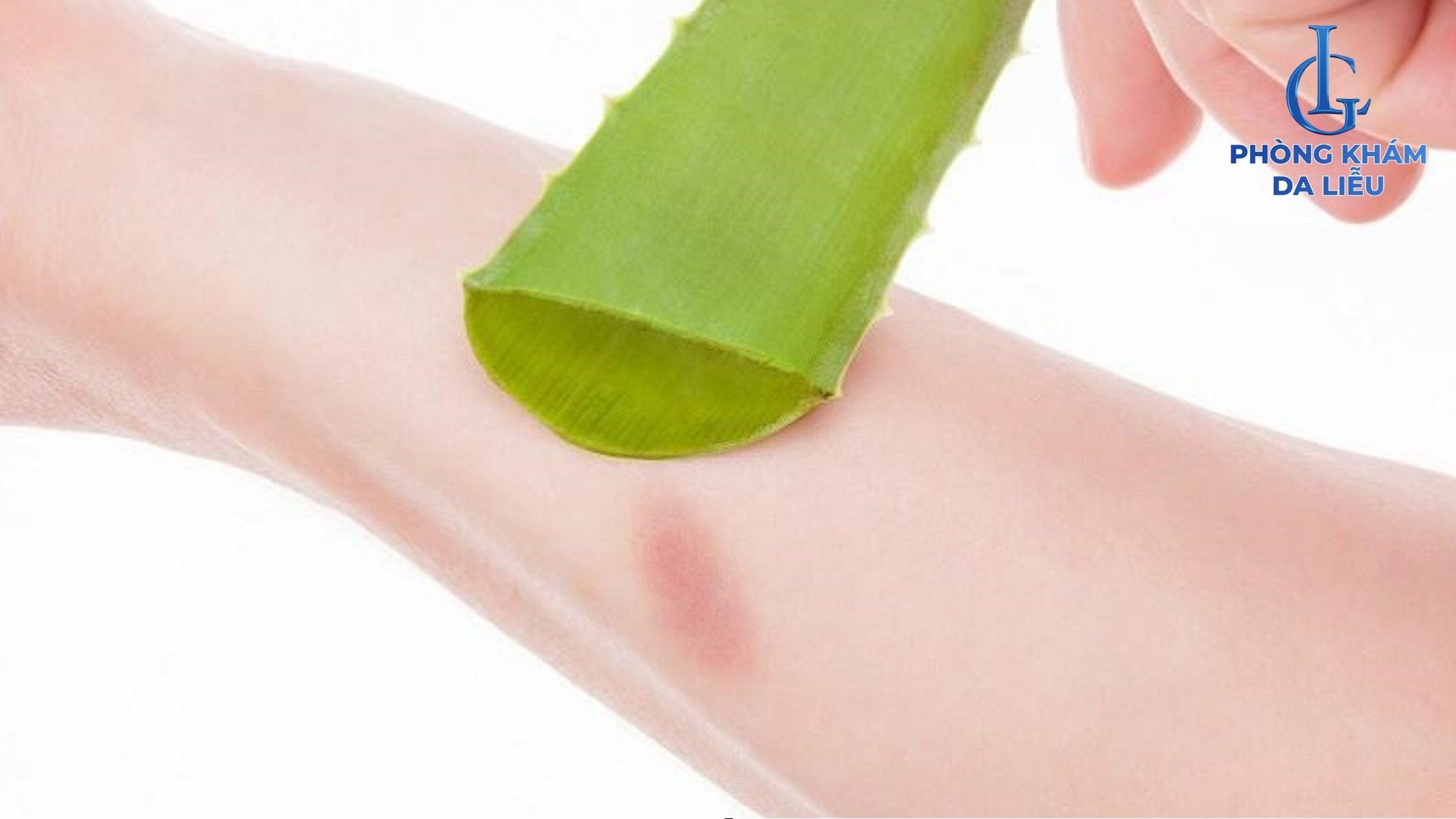 nha đam trị sẹo