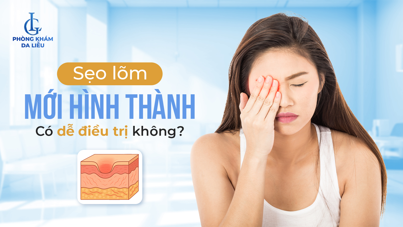 Sẹo lõm mới hình thành