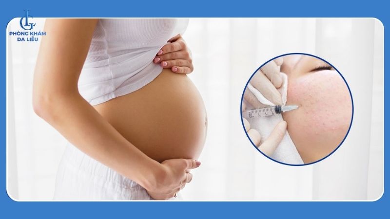 tiêm đầy sẹo rỗ