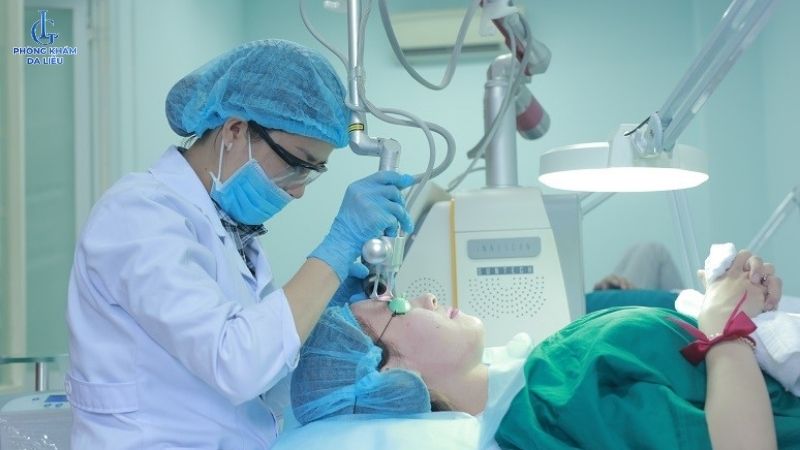 Điều trị sẹo rỗ bằng laser co2