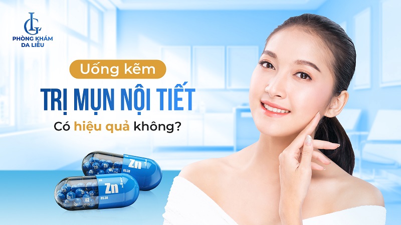 uống kẽm trị mụn nội tiết được không?