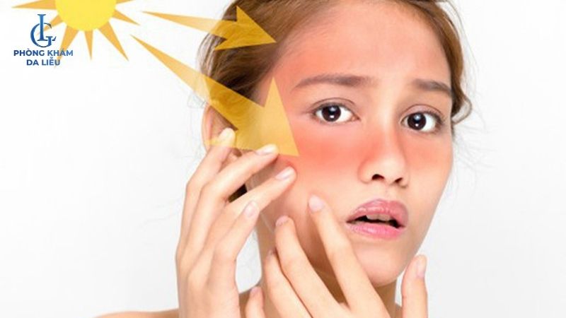 tổn thương da gây sẹo