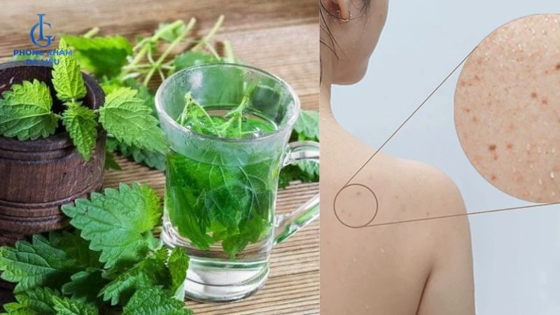 Bạc hà tươi trị mụn lưng trong 1 tuần