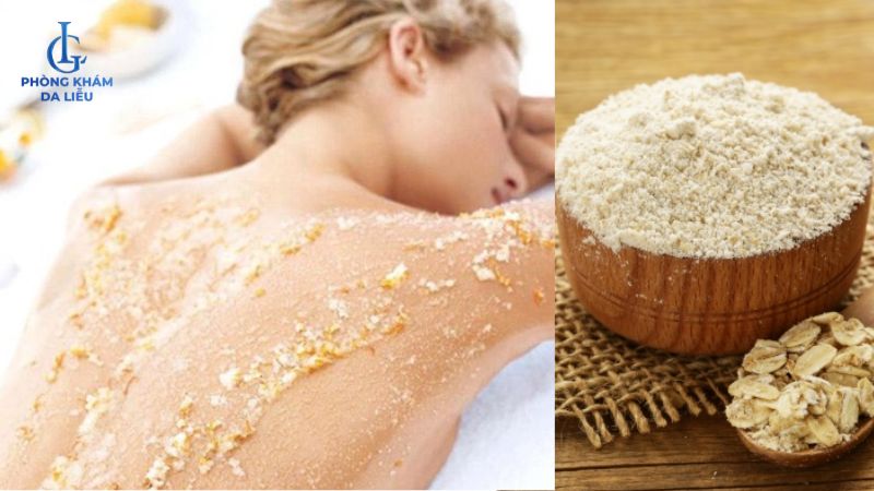 Yến mạch trị mụn lưng tại nhà