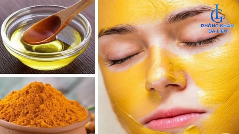 Nguyên liệu thiên nhiên trị mụn