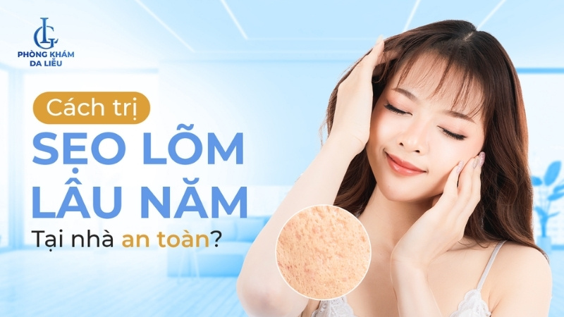 cách trị sẹo lõm lâu năm