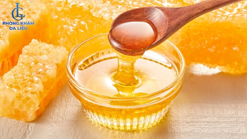 cách trị sẹo rỗ bằng mật ong tại nhà