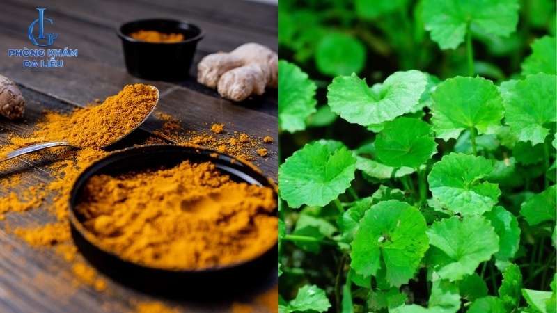 cách trị sẹo lõm bằng rau má