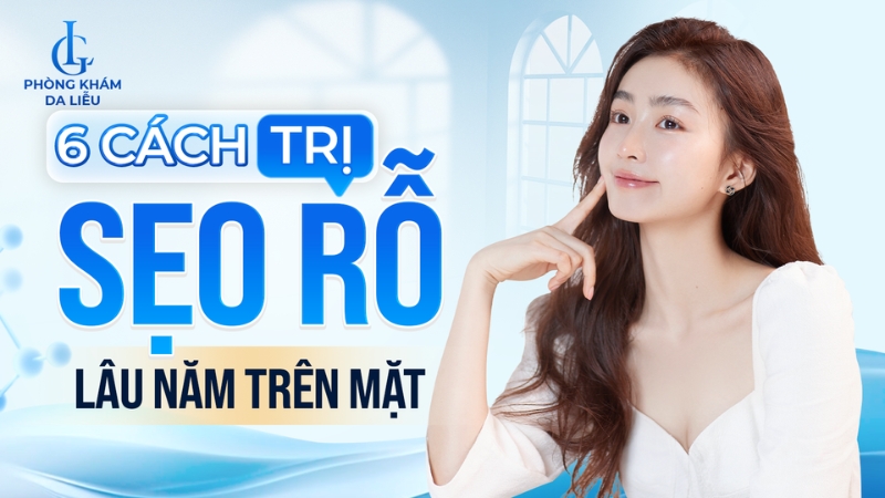 Cách trị sẹo rỗ lâu năm trên mặt tại nhà