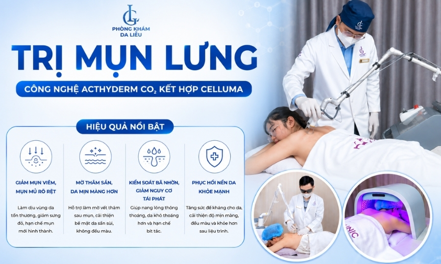 điều trị mụn lưng