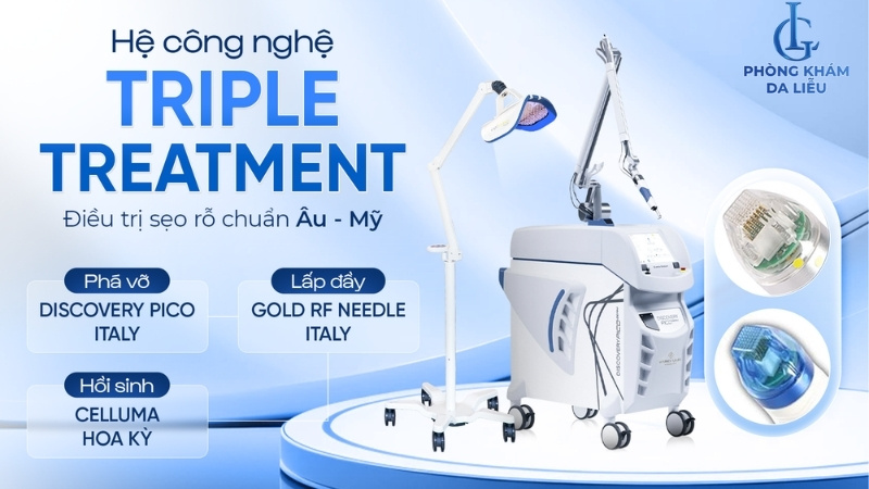 điều trị sẹo lõm lâu năm triple treatment