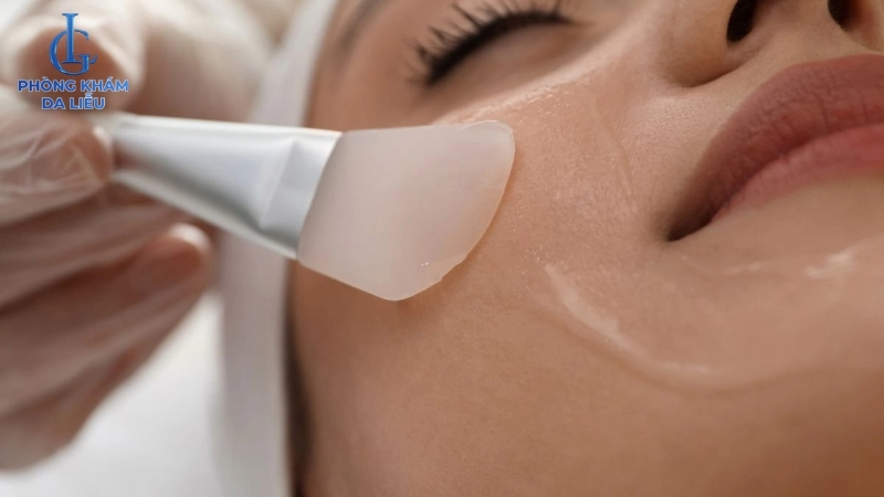 điều trị sẹo rỗ bằng cách peel da
