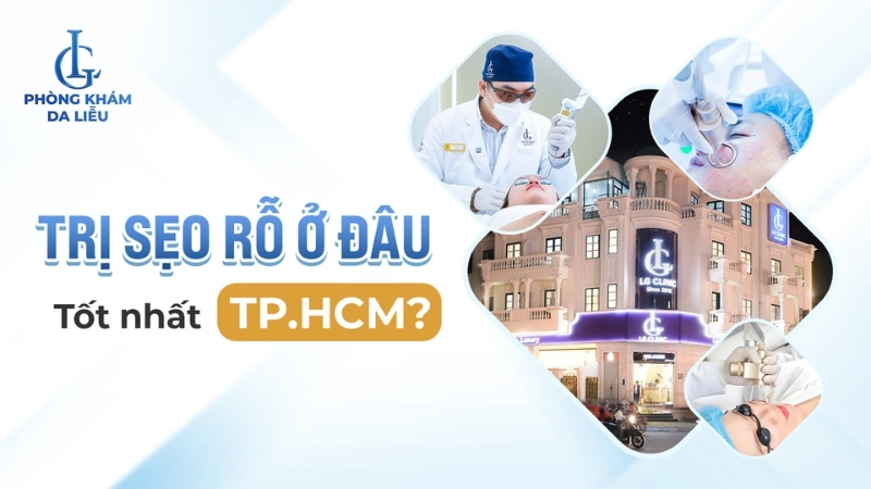 điều trị sẹo rỗ ở tphcm