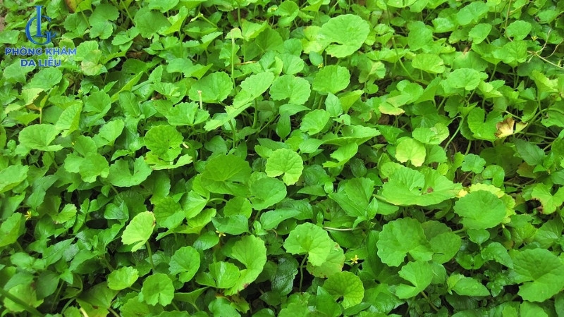dùng sản phẩm chiết xuất rau má trị sẹo lõm tại nhà