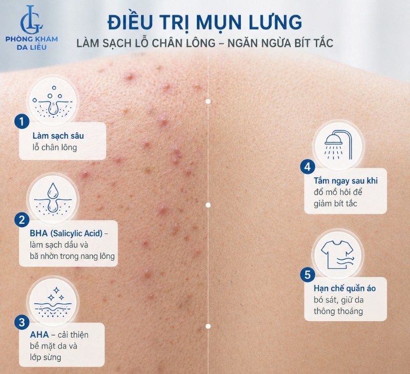 làm sạch chỗ chân lông điều trị mụn lưng ở nữ
