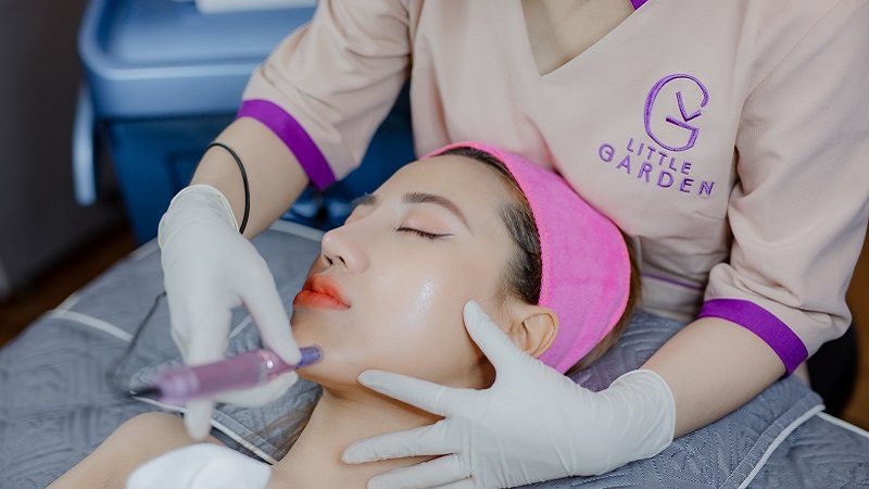 lộ trình peel da mụn