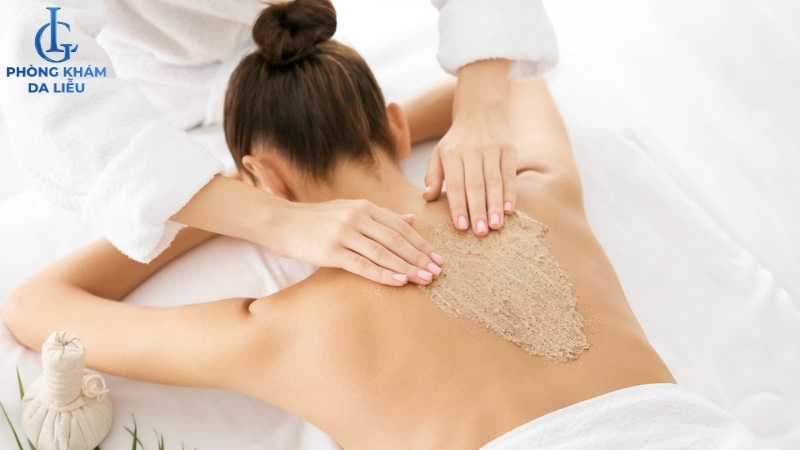 lưu ý khi điều trị mụn lưng tại nhà