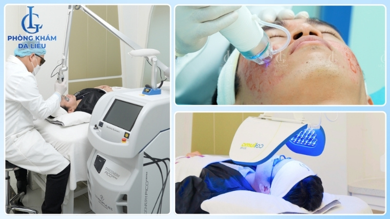 mức độ đau tùy vào công nghệ trị sẹo rỗ