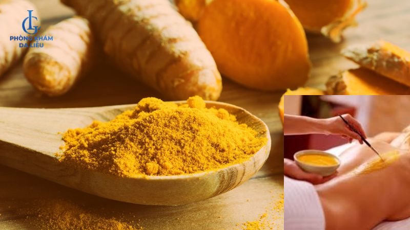 Tinh bột nghệ trị mụn lưng ở nữ