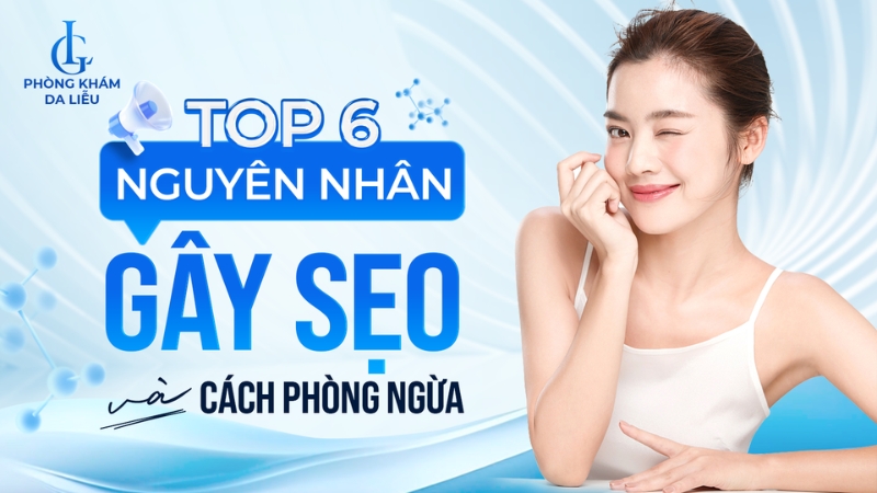 6 nguyên nhân gây sẹo rỗ