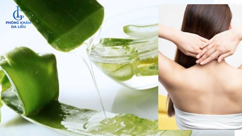 Nha đam trị mụn lưng tại nhà