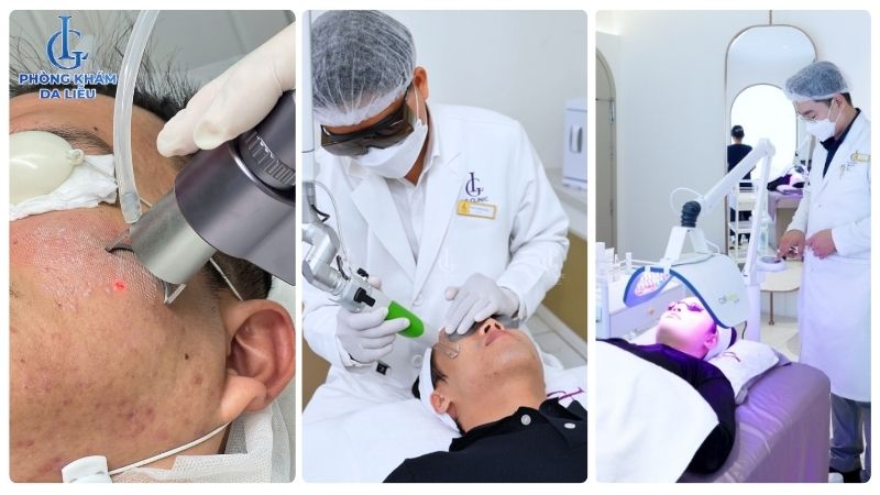 Sẹo rỗ có tự hết không
