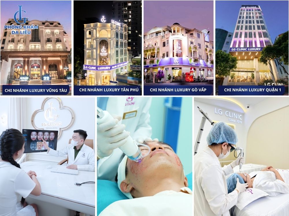 Sẹo rỗ có hết không. Địa chỉ trị sẹo rỗ uy tín HCM