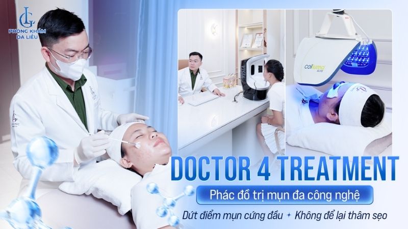 Doctor 4 treatment trị mụn