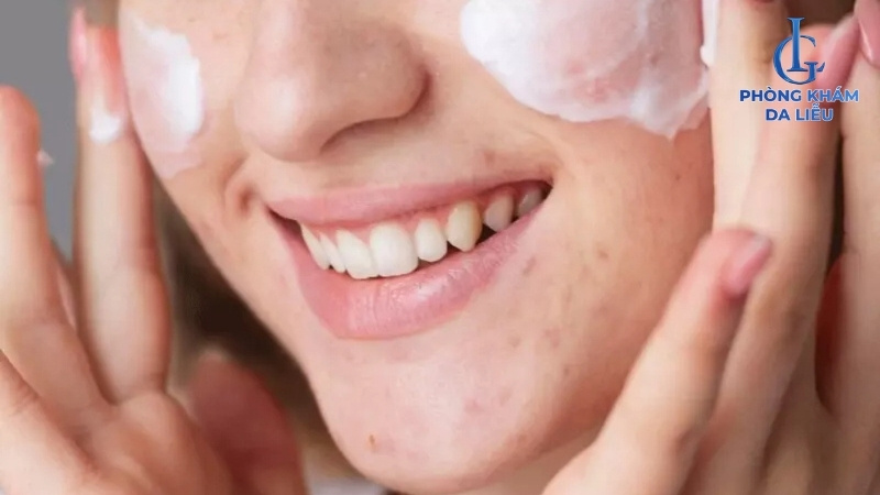 tẩy nốt ruồi bị sẹo lõm