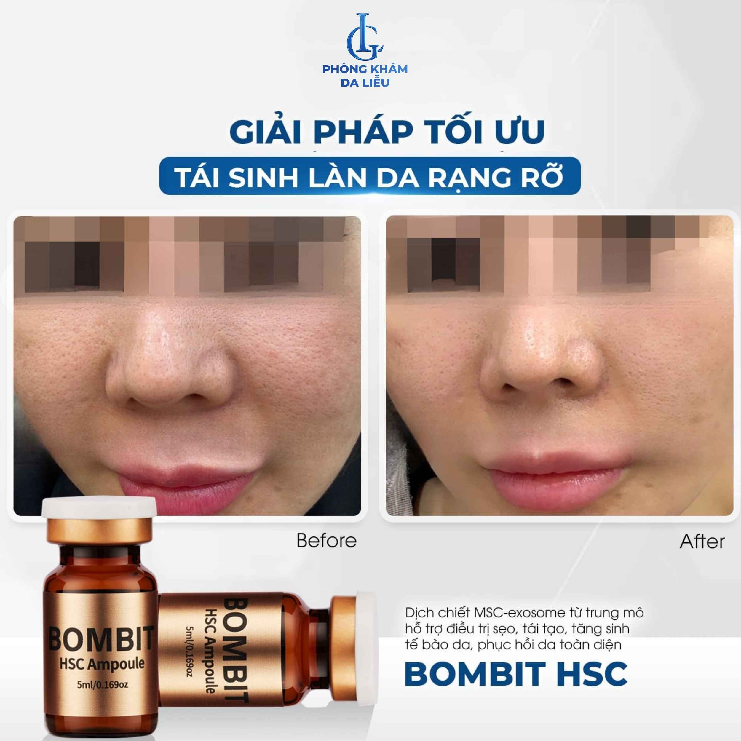 Bombit HSC Ampoule