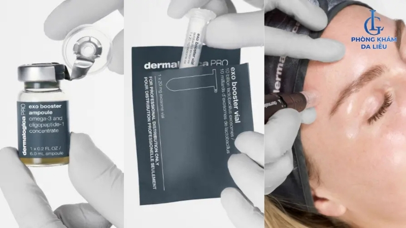 tế bào trị sẹo rỗ