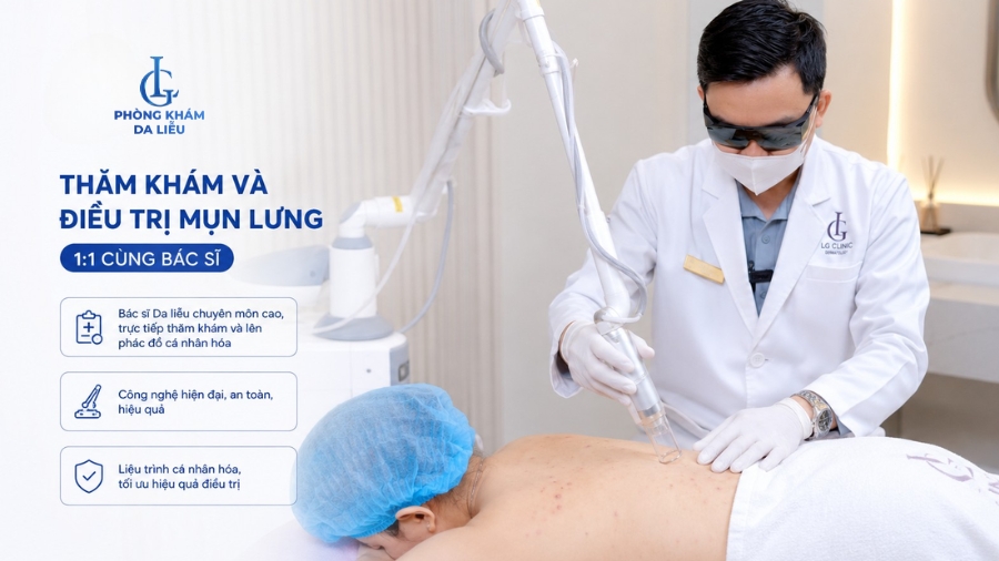 thăm khám điều trị mụn lưng 1-1 với bác sĩ