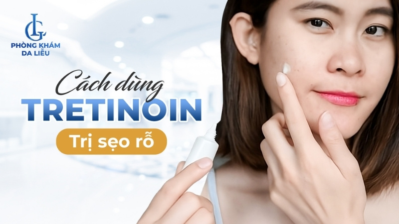 tretinoin trị sẹo rỗ có được không