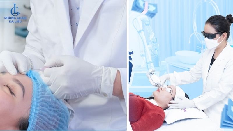 công nghệ trị sẹo lõm lâu năm