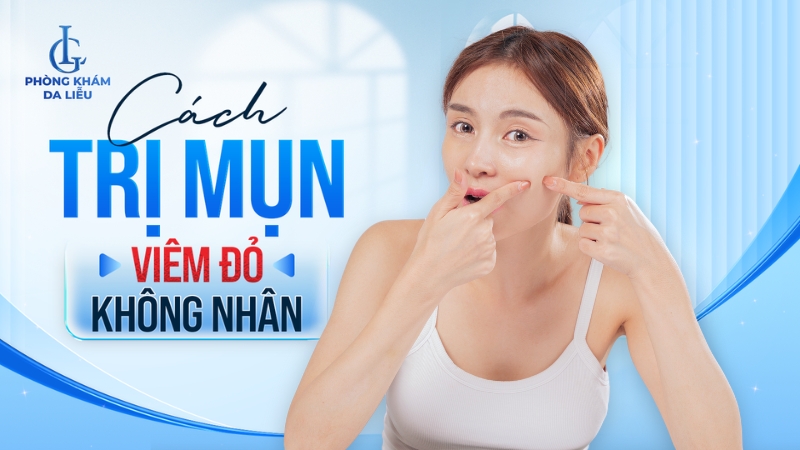 Cách trị mụn viêm đỏ không nhân