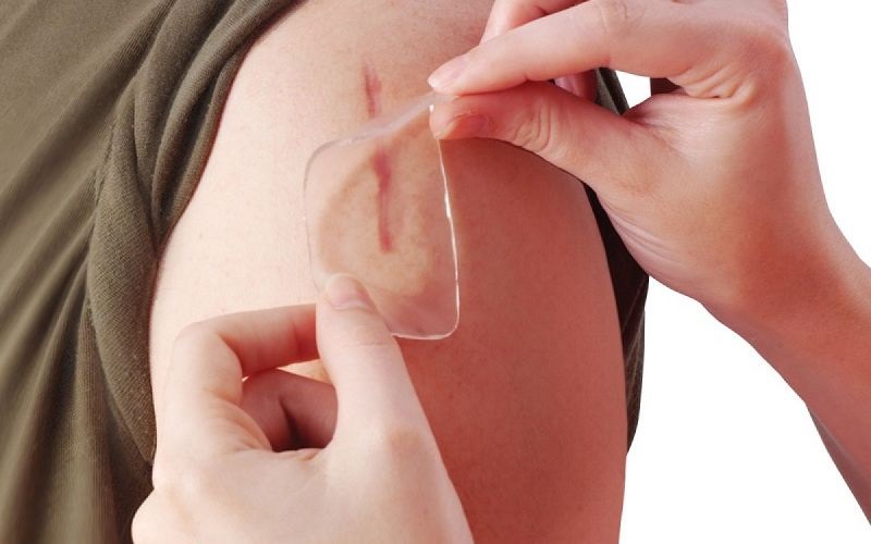 trị sẹo lồi lâu năm