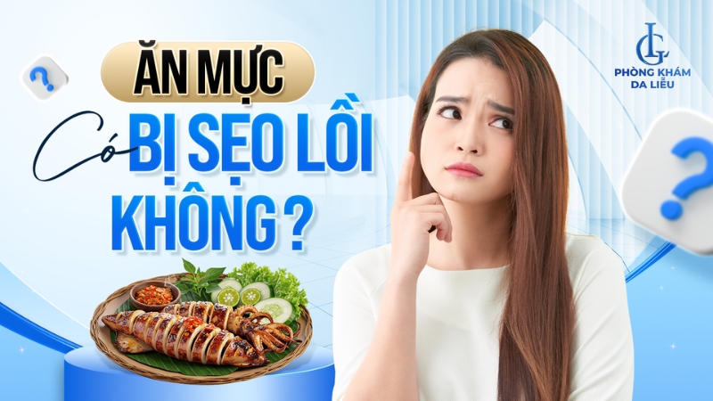 Ăn mực có bị sẹo lồi không?