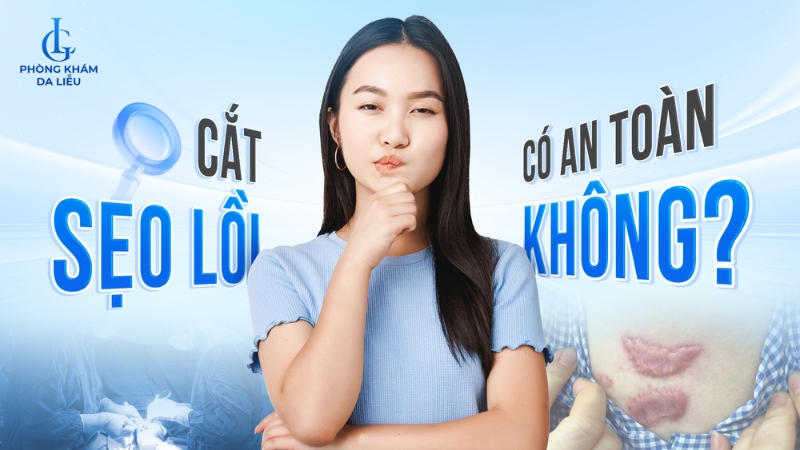Phẫu thuật cắt sẹo lồi
