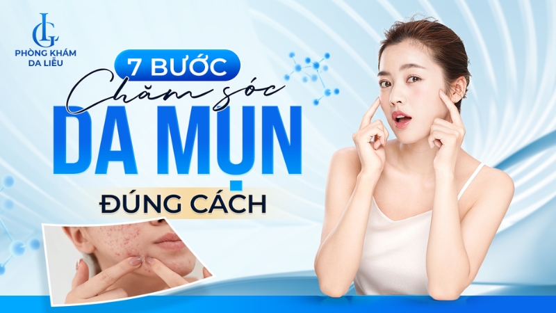 7 bước chăm sóc da mụn
